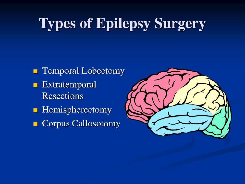 PPT - Epilepsy Surgery PowerPoint Presentation, free download - ID:3088062