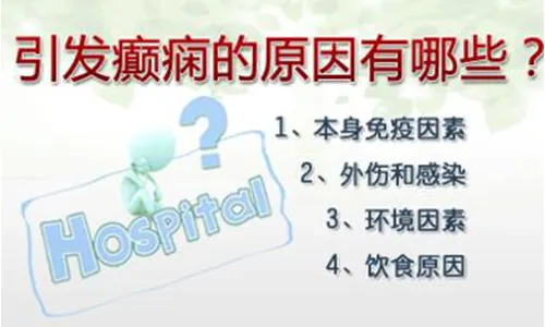 重庆癫痫医院_治疗癫痫的费用是多少?