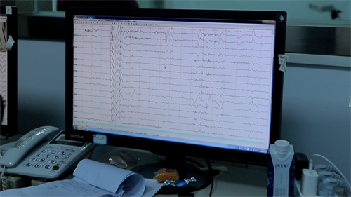 重庆癫痫患儿能做脑电图吗？