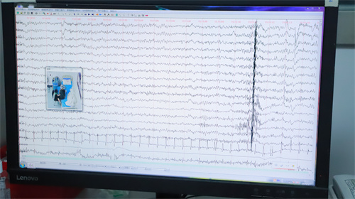 重庆脑电图能检查出什么疾病？